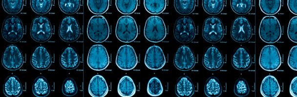 Dispatch from the Digital Frontier: Engagement and the Dopamine Squirt